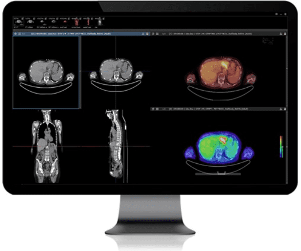 院内サーバー型画像管理システム